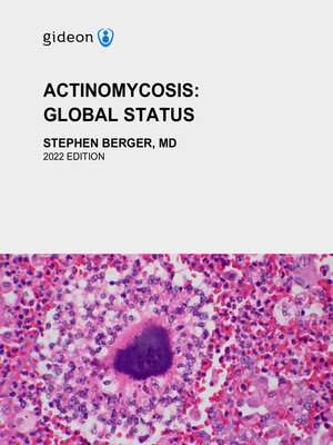 cover image of Actinomycosis
